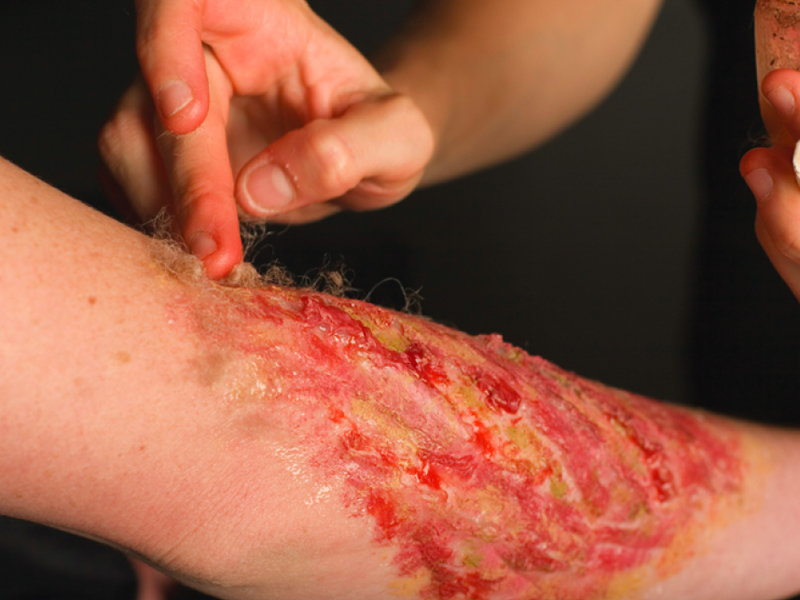 Halloween:&nbsp;Wounds