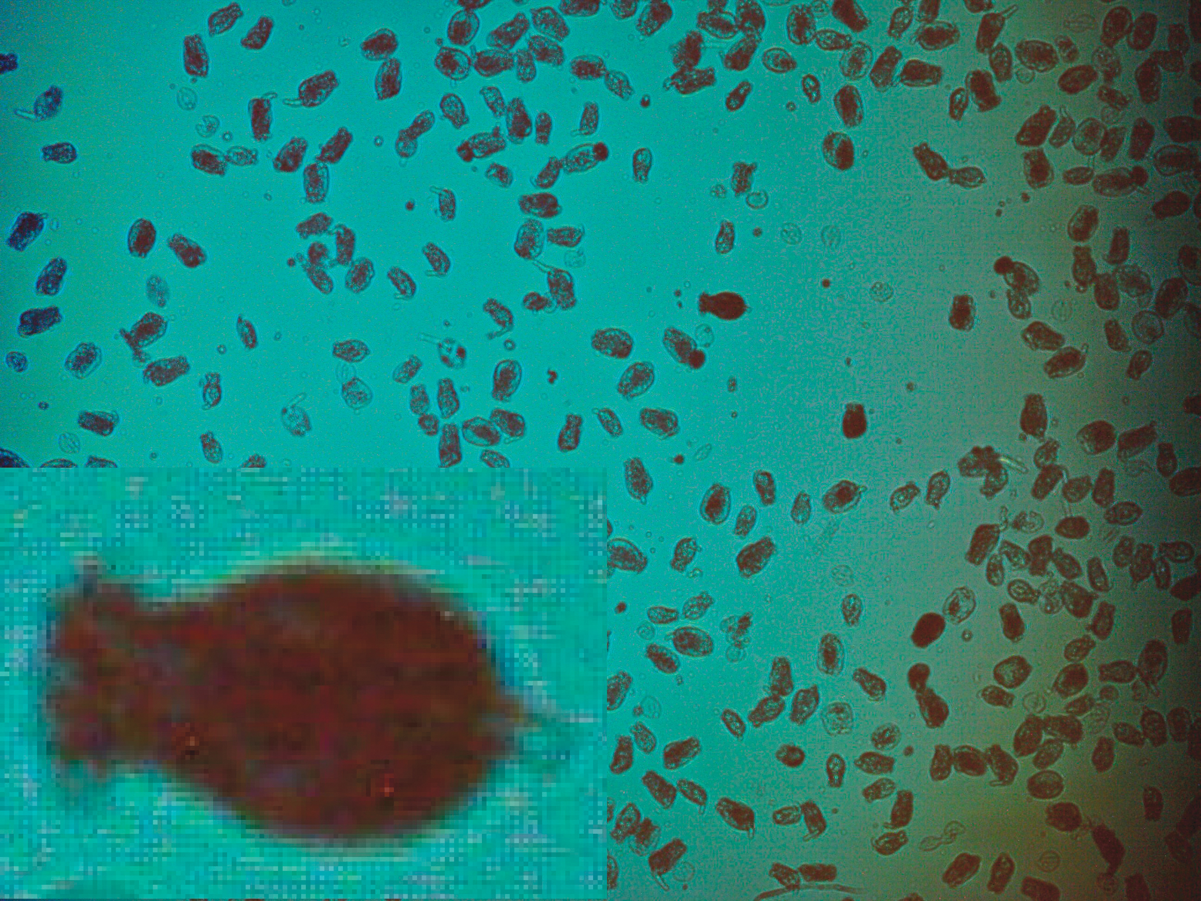 New Project: Lensless Microscope